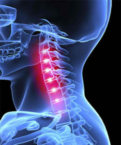 Neck Pain